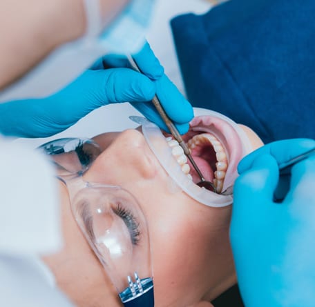 Composite Fillings Pakenham