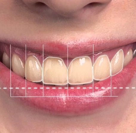 Digital Smile Design Pakenham