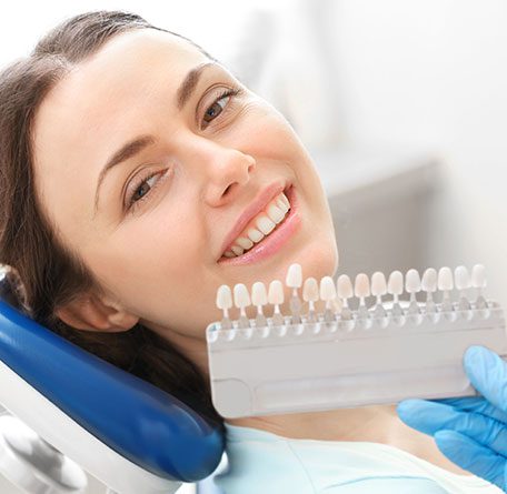 Veneers gallery