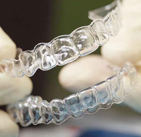 clear aligner image