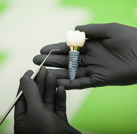 dentist-explaining-teeth-model