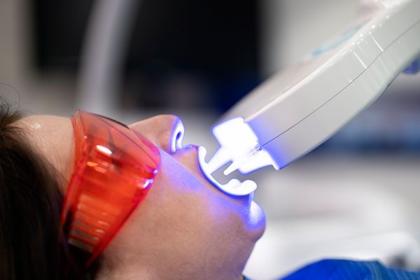 Teeth-whitening