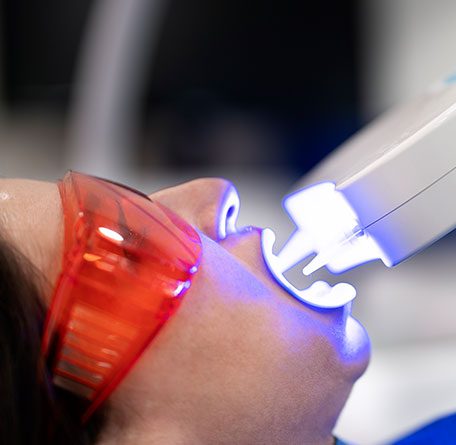 Teeth-whitening